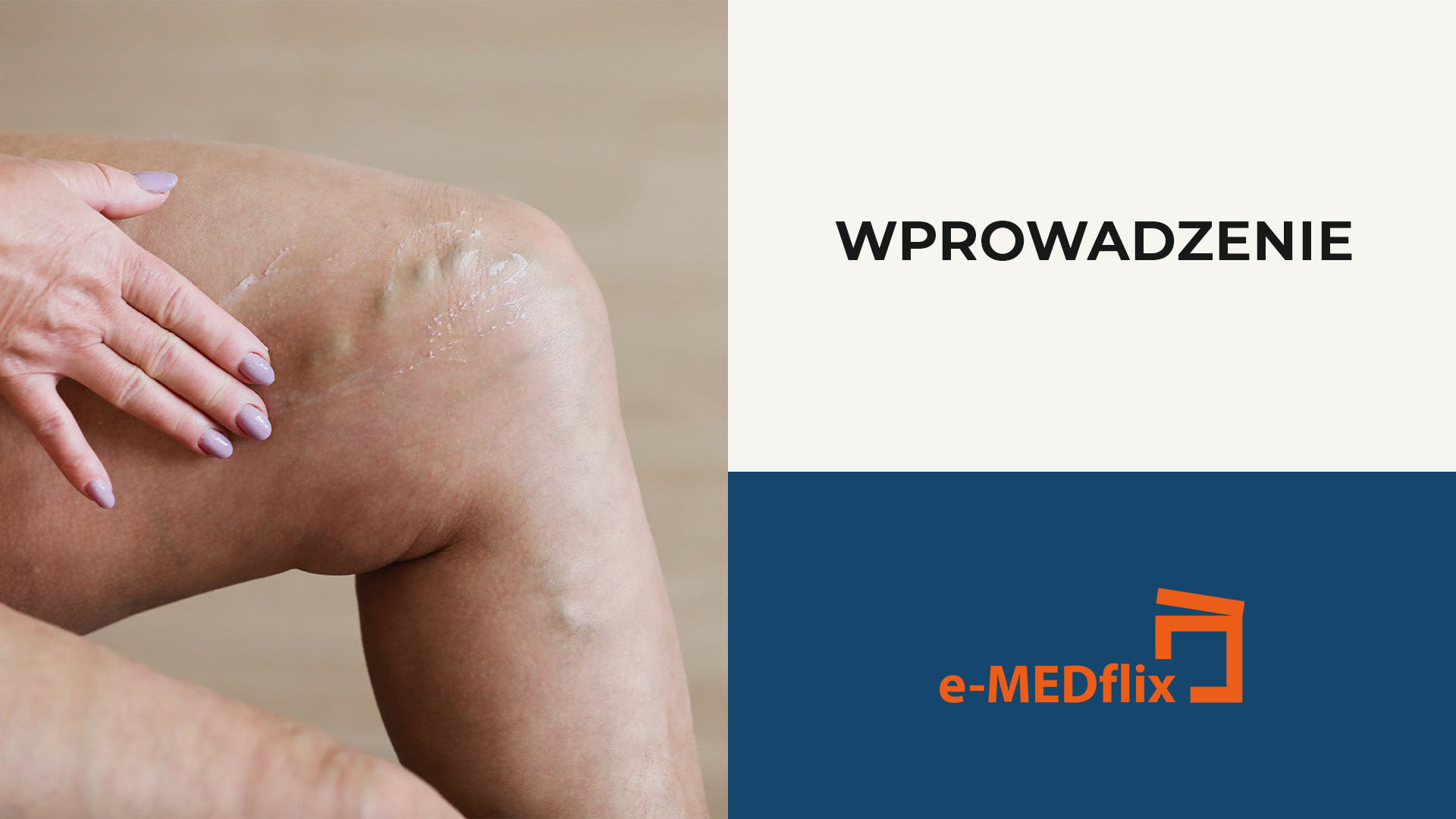 Przewlekła Niewydolność Żylna w pigułce – diagnostyka i leczenie_ wpr