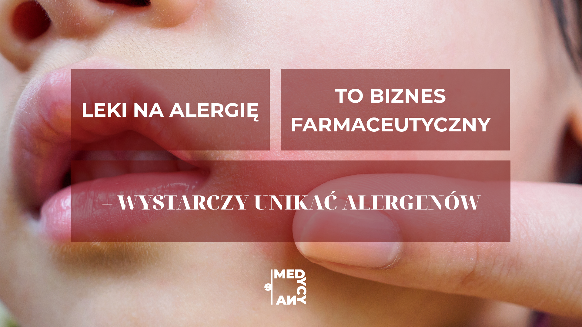 Leki na alergie to biznes
