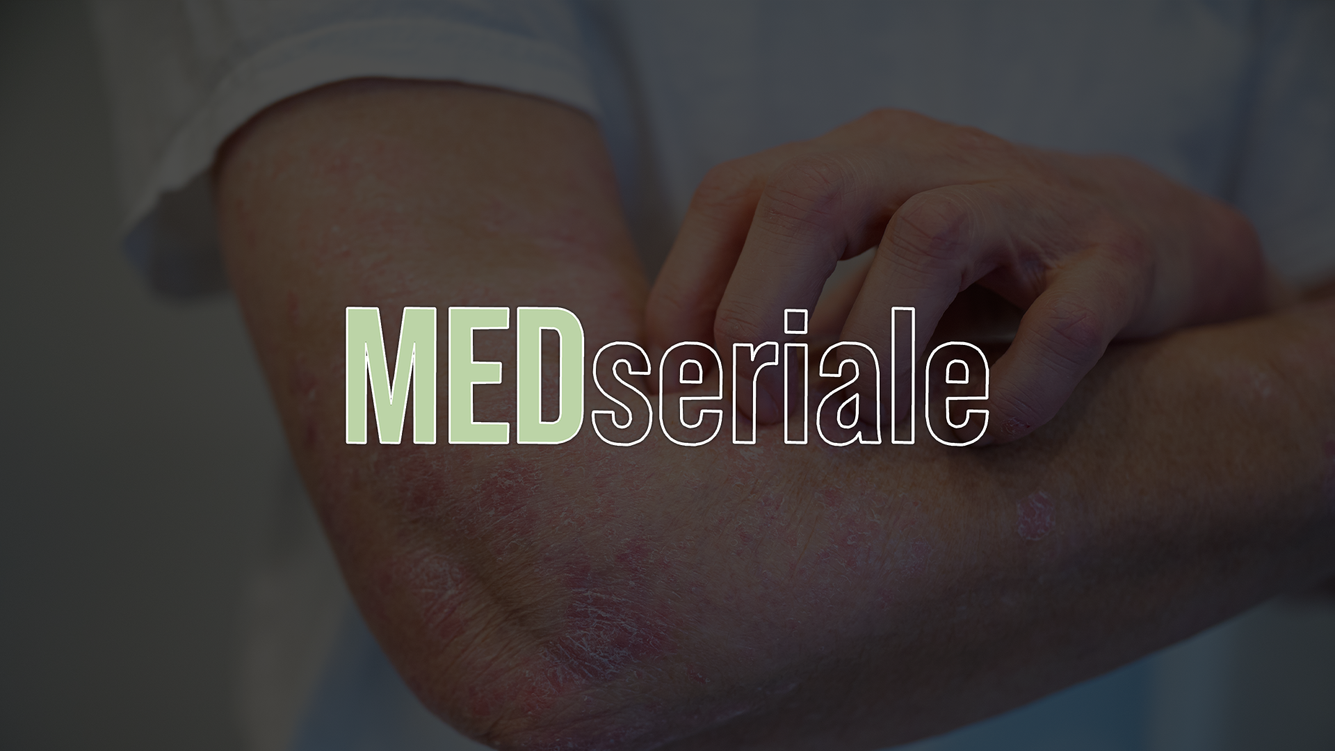 Łuszczyca w praktyce POZ – diagnoza, leczenie, monitorowanie | Case Study 2