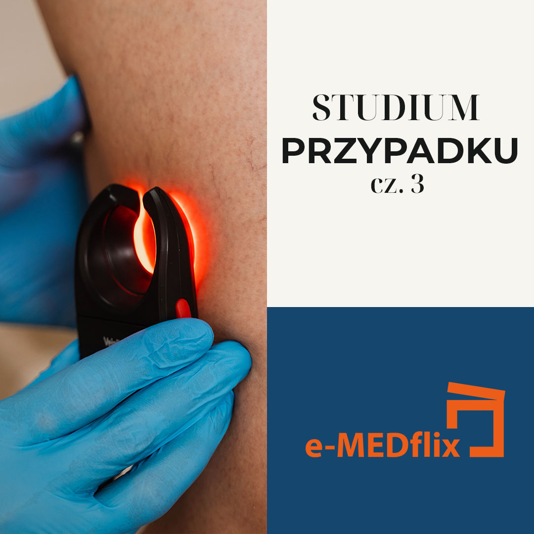 medflix-CASE STUDY 3- Leczenie chorób naczyń obwodowych.png
