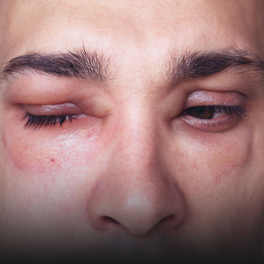 innowacyjna hae profilaktyka.png