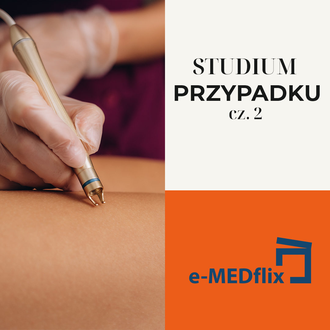 medflix-CASE STUDY 2 - Leczenie chorób naczyń obwodowych.png