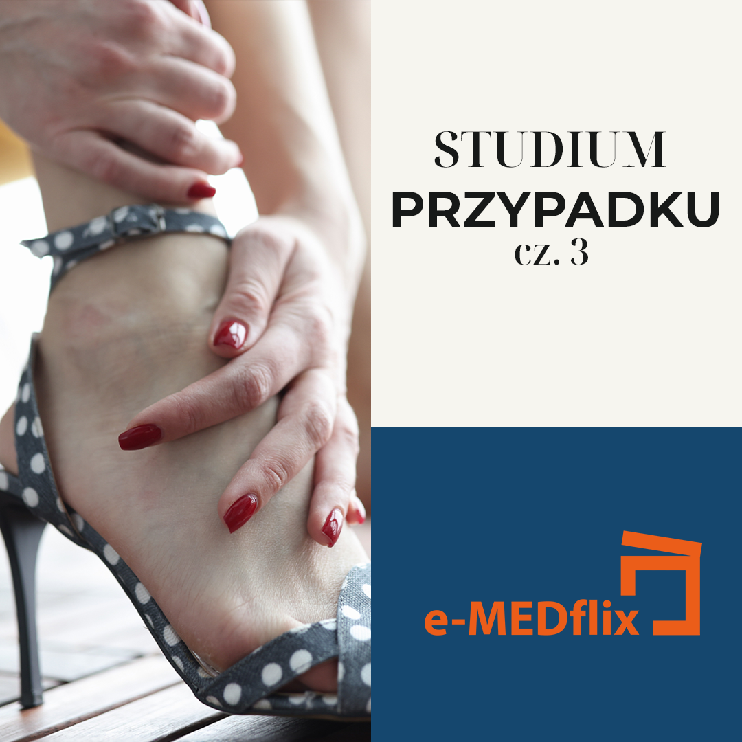 e-medflix_żyły w lecie_CS3.png