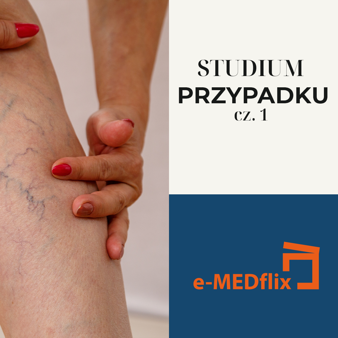 e-medflix_żyły w lecie_CS1.png